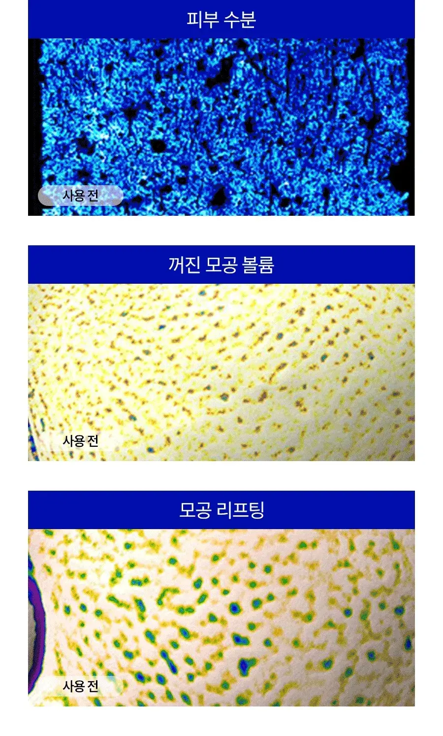 [모공플럼핑 수분앰플] 메디필 히알루론산 레이어 물톡스 앰플 30ml 상세페이지 10